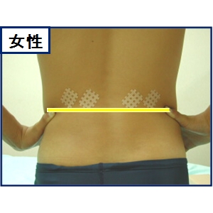 男女別腰痛 テープの貼り方 症状検索